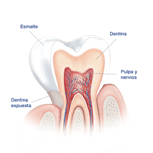 Dentina, causa de los dientes sensibles