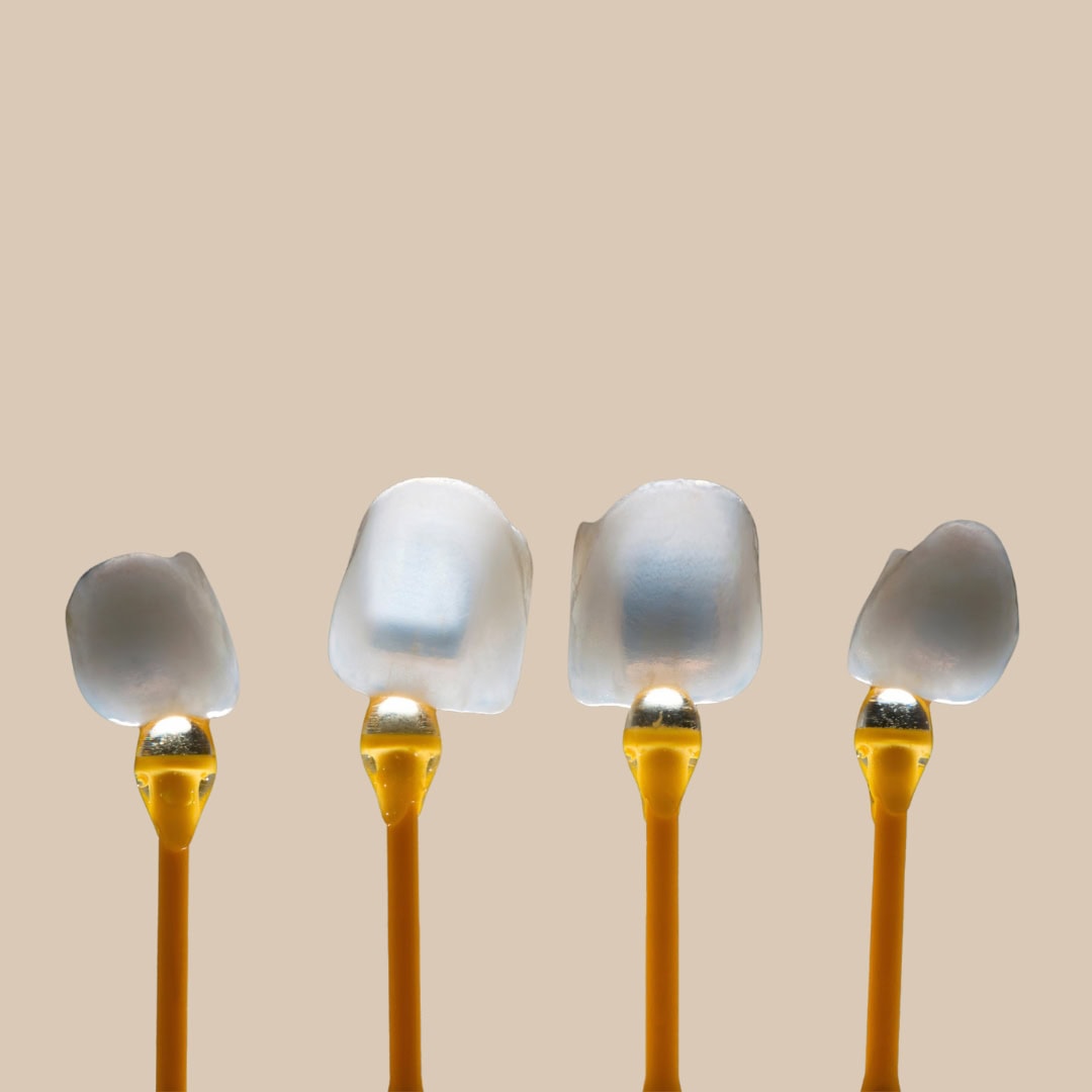 Carillas Dentales | Clínica Dental Satorres