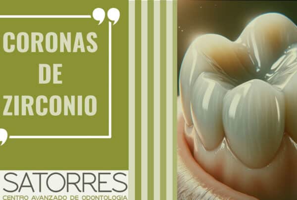 Banner Coronas de Zirconio | Clínica Dental Satorres