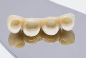 Coronas Zirconio | Clínica Dental en Paterna y Manises