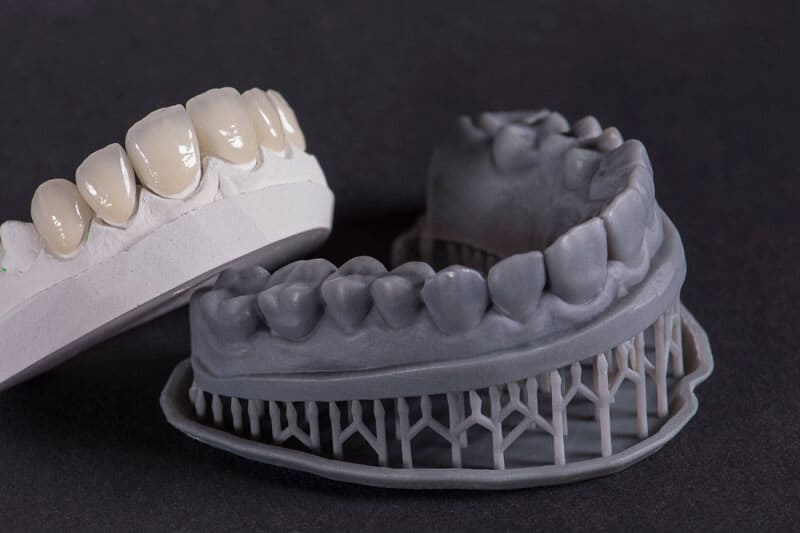 Durabilidad del Mock up | Clínica Dental Satorres en Paterna y Manises