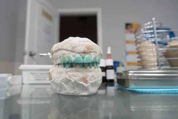 Resinas para Mockup | Clínica Dental Satorres en Paterna y Manises