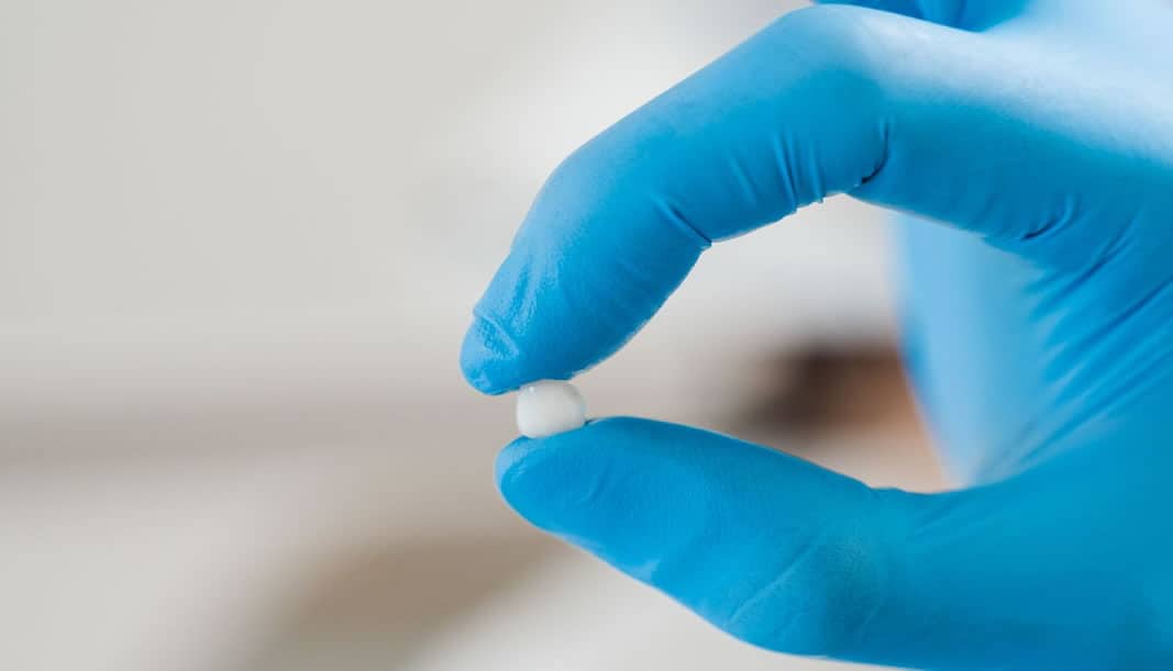 Un ejemplo de Carillas de Clínica Dental Satorres en Valencia