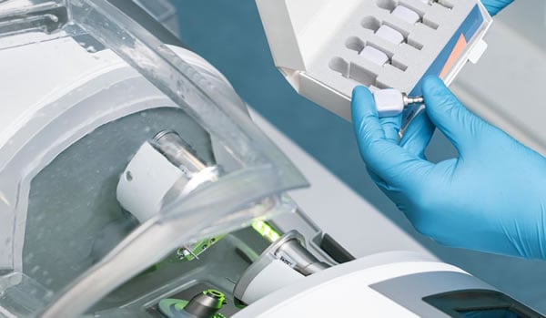 Fabricación de Carillas de Clínica Dental Satorres en Valencia