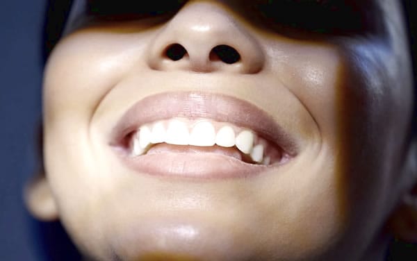 Sonrisa perfecta con Cariññas de Clínica Dental Satorres en Valencia