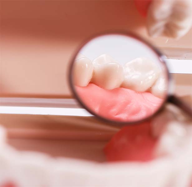 Encías Inflamadas | Clínica Dental Satorres | Paterna Manises