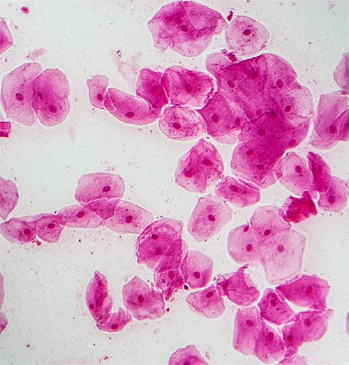 Bacterias Bucodentales | Clínica Dental Satorres | Paterna Manises