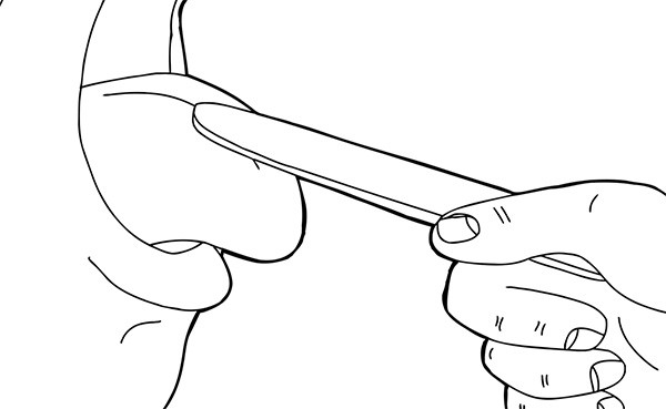 Revisión Candidiasis Oral | Clínica Dental Satorres