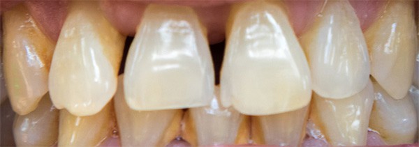 Sarro Dental | Clínica Dental Satorres | Paterna Manises