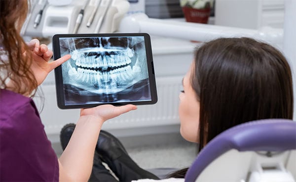 Dentista debe aconsejar Lentisco | Clínica Dental Satorres | Paterna Manises