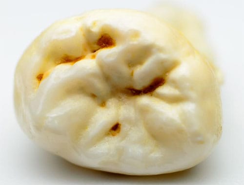 Caries en la Disgeusia Oral | Clínica Dental Satorres Valencia