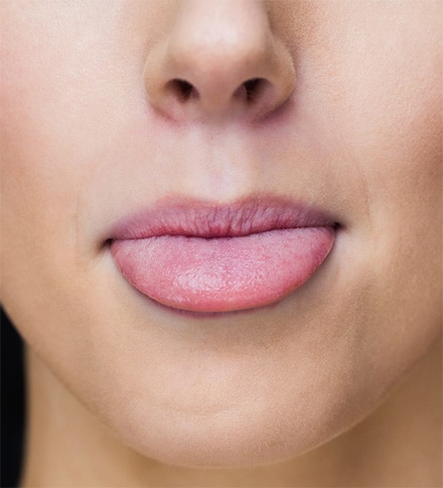 Lengua sana - Limpiador Lingual | Clínica Dental Satorres - Paterna Manises