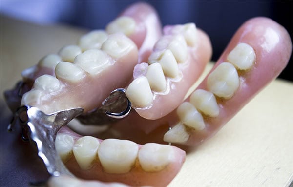 Dentaduras Postizas usadas | Clínica Dental Satorres Paterna Manises