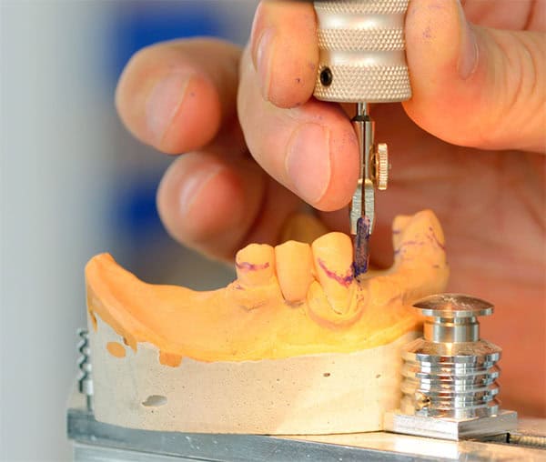 Fabricación dentadura Postiza | Clínica Dental Satorres Paterna Manises