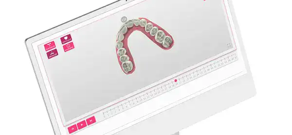 Ventajas Ortodoncia Invisible Geniova | Clínica Dental Satorres