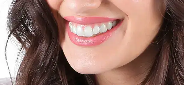 Ventajas Ortodoncia Invisible Geniova | Clínica Dental Satorres