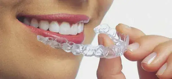 Ventajas Ortodoncia Invisible Geniova | Clínica Dental Satorres