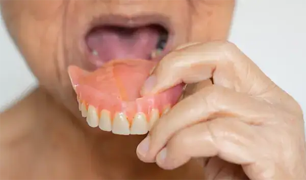 Perdida de dientes en mayores y dentadura postiza | Clínica Dental Satorres