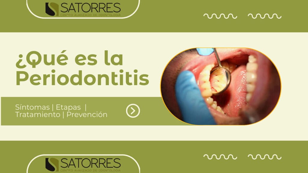 Banner que es la Periodontitis | Clínica Dental Satorres Valencia