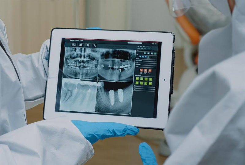 Radiografía dental de Periodontitis | Clínica Dental Satorres Valencia