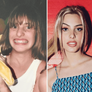 Lele Pons - Famosos y Carillas Dentales | Clínica Dental Satorres