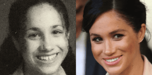 Meghan Markle - Famosos y Carillas Dentales | Clínica Dental Satorres