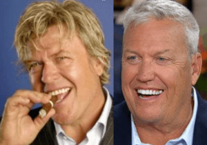 Rex Ryan - Famosos y Carillas Dentales | Clínica Dental Satorres