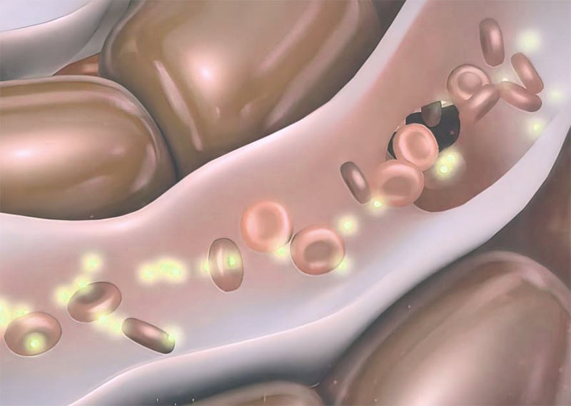 Contagio virus - Herpes Labial | Clínica Dental Satorres Valencia