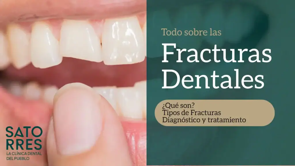 Fractura Dental Banner | Clínica Dental Satorres Paterna Manieses