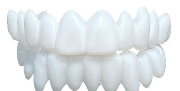 Tipos de Carilla: Removibles Snap ON | Clínica Dental Satorres Paterna Manieses