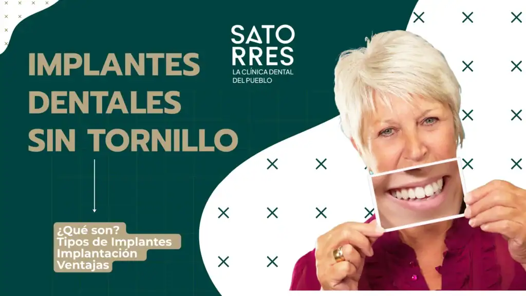 Implantes Dentales sin tornillo | Clínica Dental Satorres