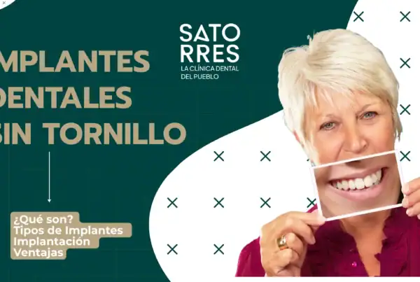 Implantes Dentales sin tornillo | Clínica Dental Satorres