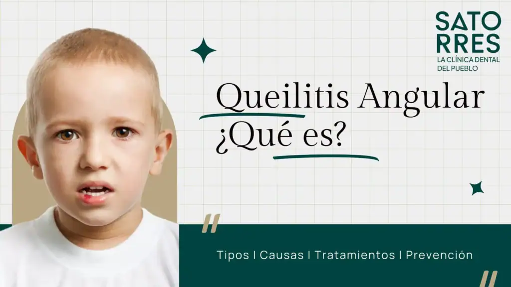 Queilitis Boqueras | Clínica Dental Satorres Paterna Manises