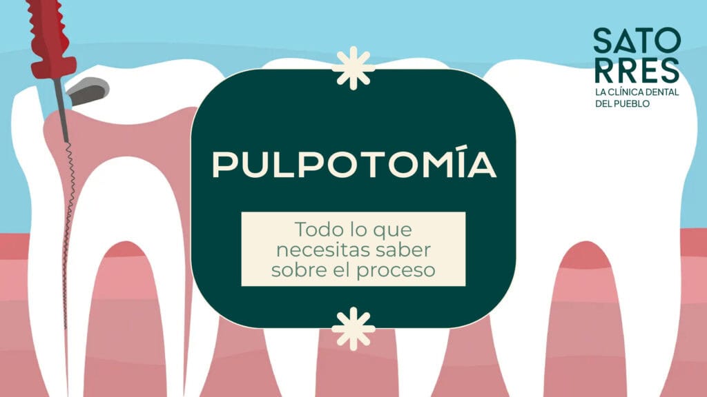 Banner Pulpotomía | Clinica Dental Satorres