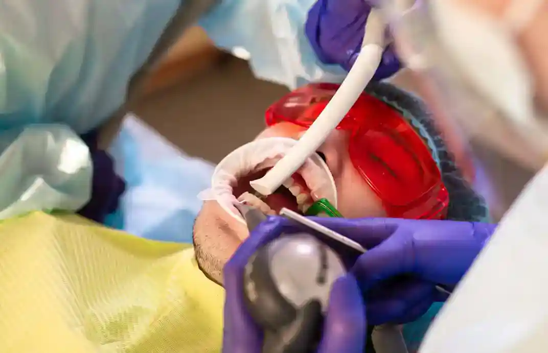 Pulpotomía | Clinica Dental Satorres