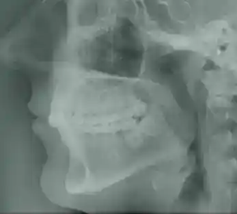 Radiografía | Clínica Dental Satorres - Paterna - Manises
