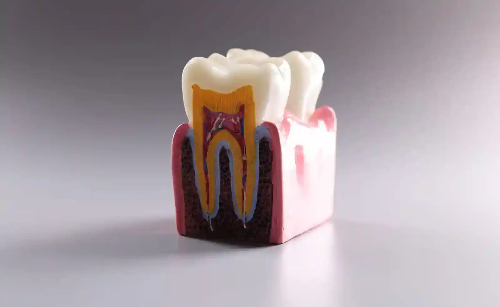 Sección del diente | Clínica Dental Satorres - Paterna Manises