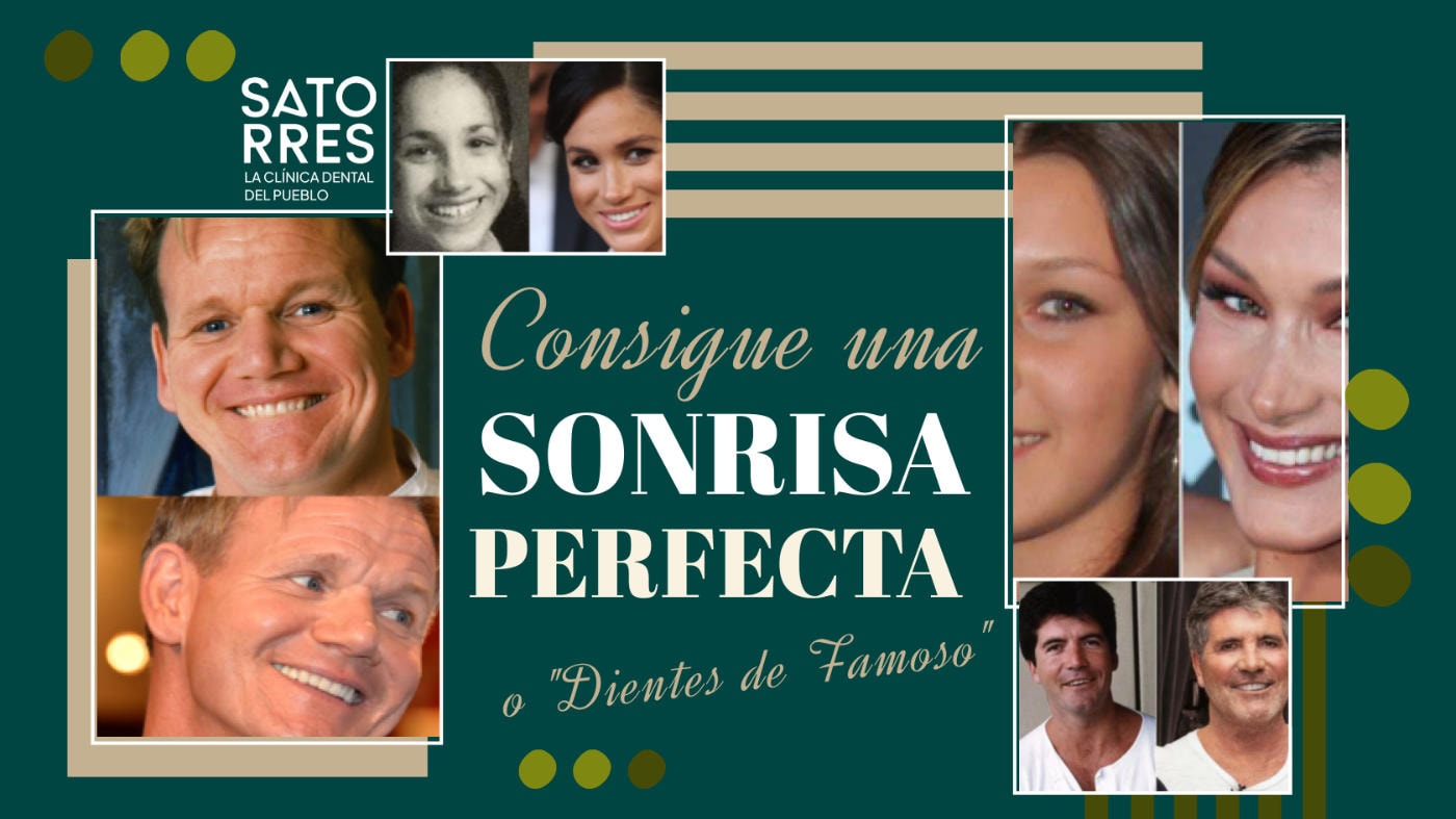 Como tener una Sonrisa Perfecta o «Dientes de famoso»