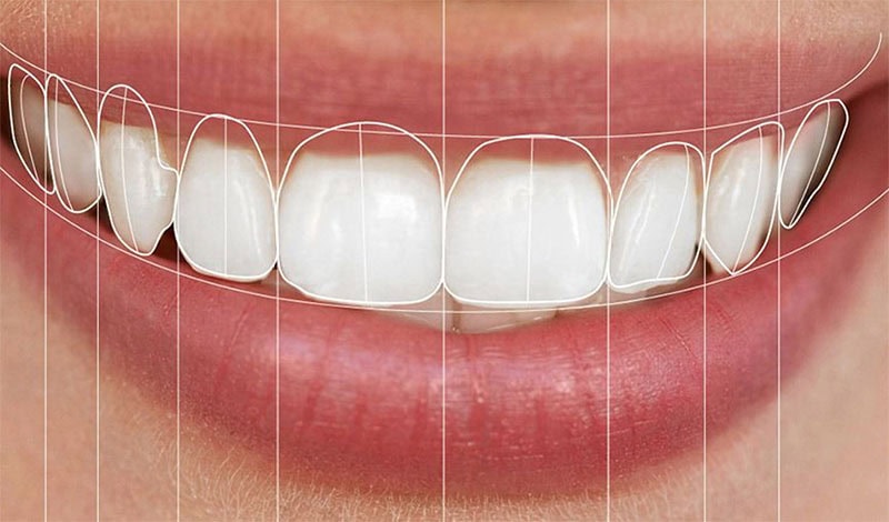 Diseño computerizado de sonrisa | Clínica Dental Satorres Valencia