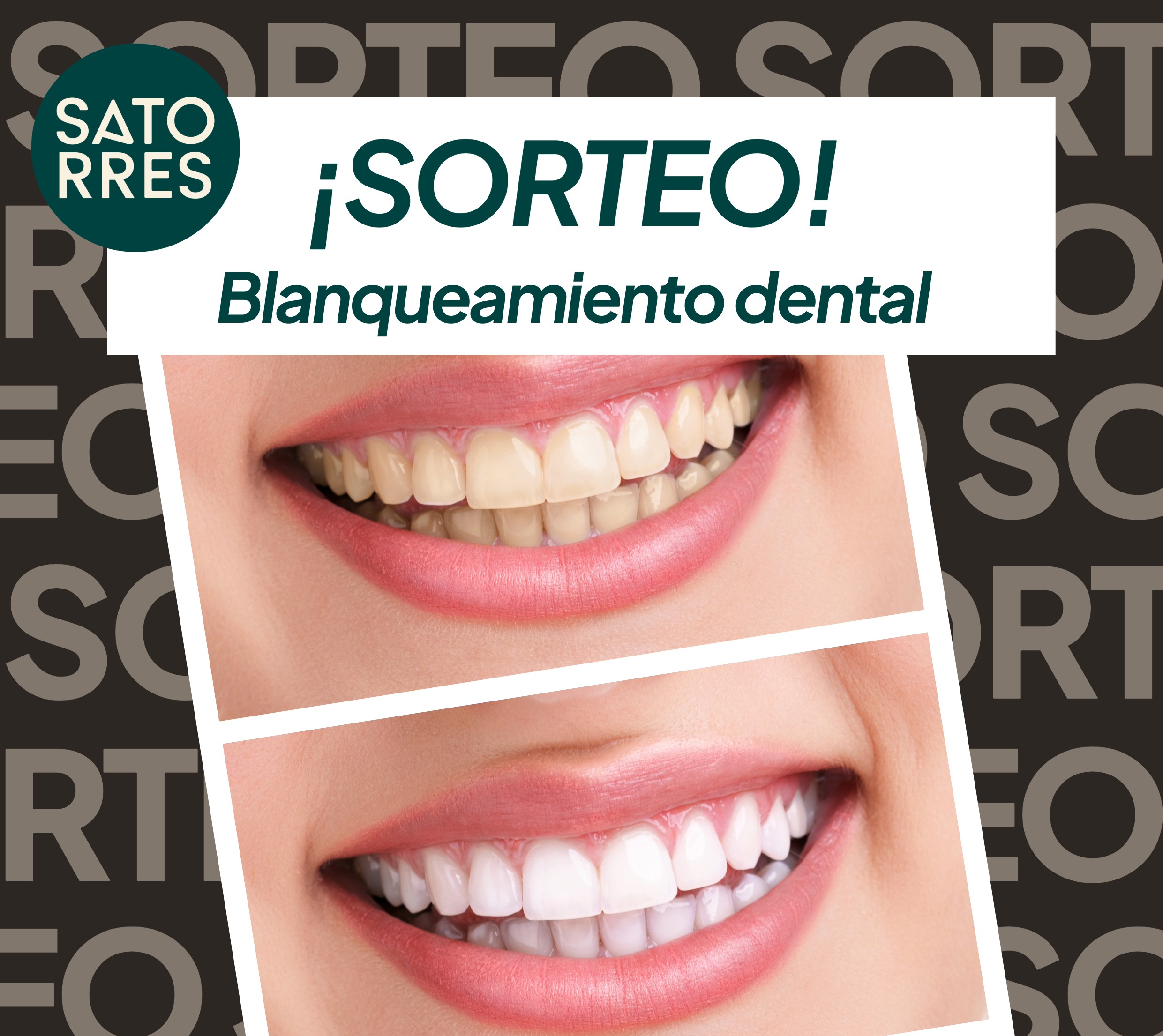 Sorteo Blanqueamiento dental 2025