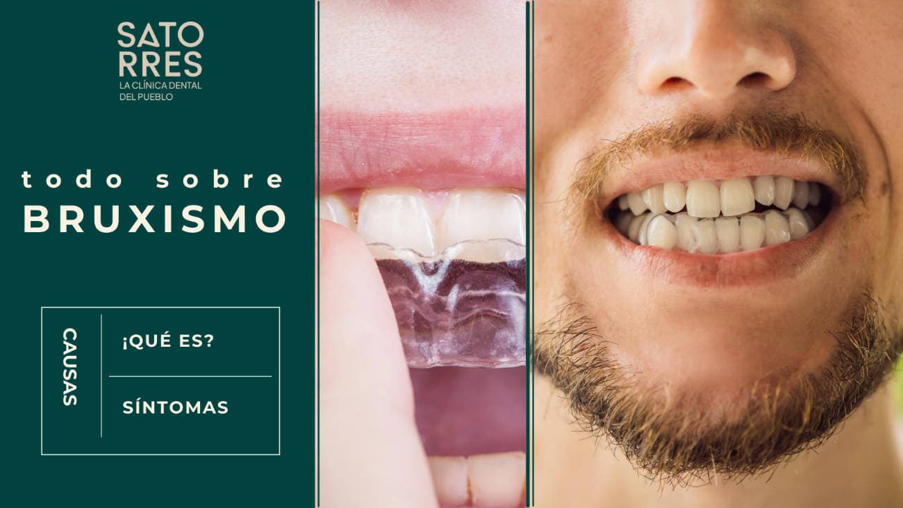 Entiende qué es el Bruxismo con Clínica Dental Satorres