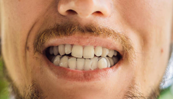 Todo sobre Bruxismo | Clínica Dental Satorres