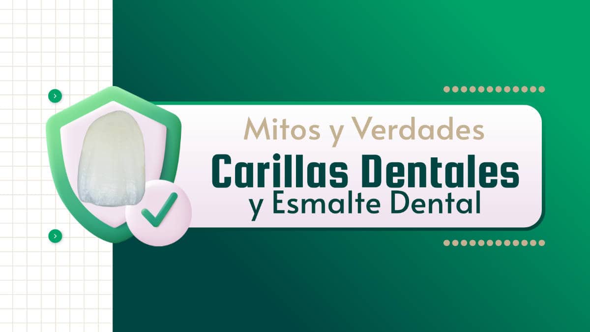 Carillas dentales, ¿Dañan el esmalte? Mitos y verdades