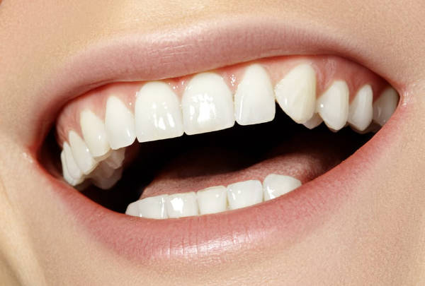 Carillas y esmalte Dental | Clínica Dental Satorres - Paterna Manises