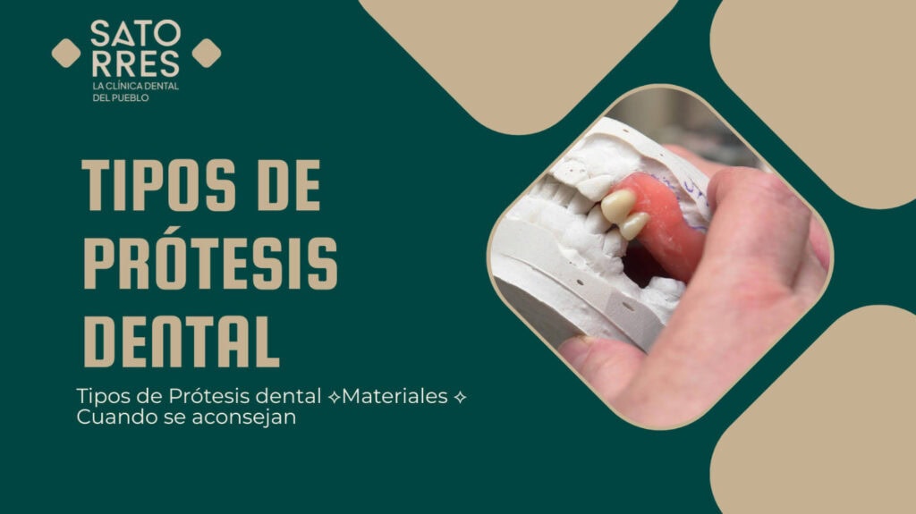 Banner Tipos de Prótesis Dental | Clínica Dental Satorres - Paterna Manises