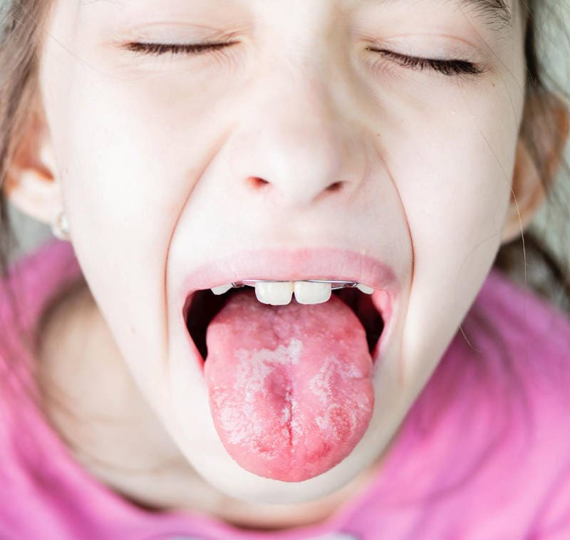 Revisión dental Infantil | Clínica Dental Satorres en Paterna y Manises