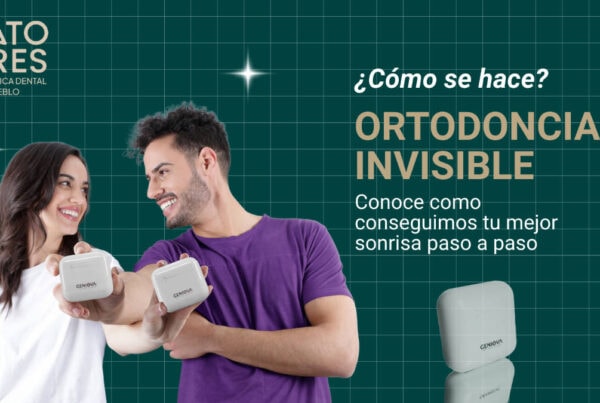 Como se hace la ortodoncia iinvisible paso a paso | Clínica Dental Satorres - Paterna - Manises