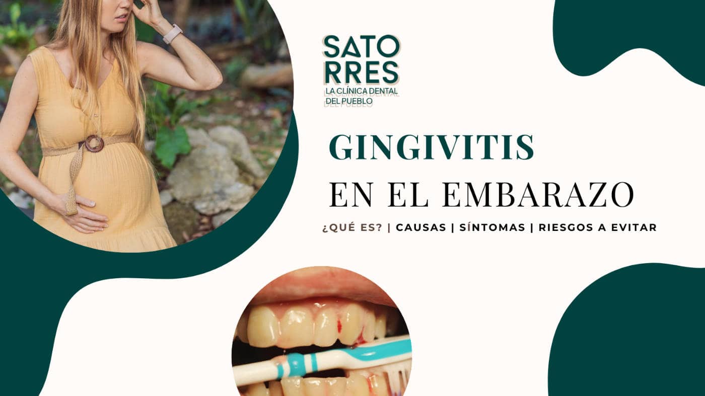 Gingivitis en el embarazo. ¿Qué es?