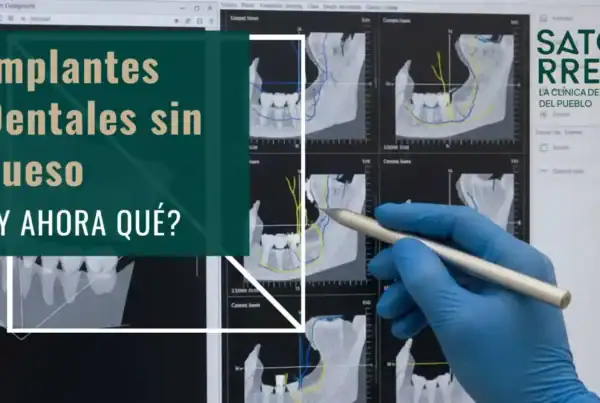 Banner Implantes Dentales con poco hueso || Clínica Dental Satorres Paterna - Manises