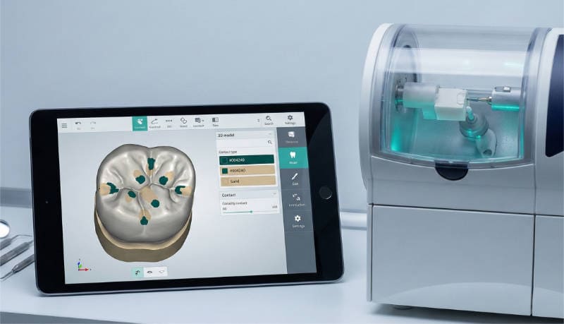 CAD-CAM Corwn Design | Odontología Digital - Clínica Satorres Paterna Manises
